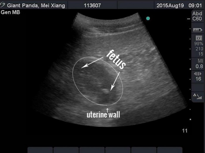 An ultrasound taken Aug. 19 shows a developing fetus.