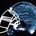 X-ray image of brain and football helmet