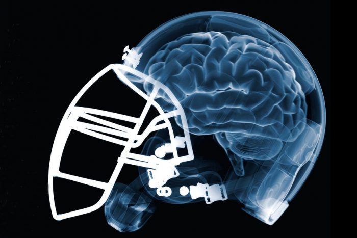 IMPACT: The Evolution of Football Helmets