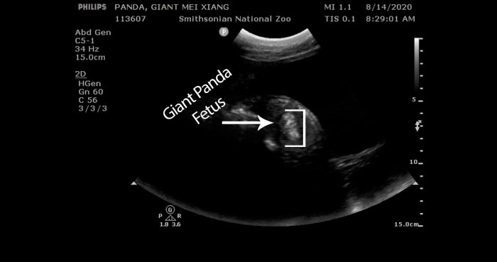 Panda ultrasound showing fetal tissue